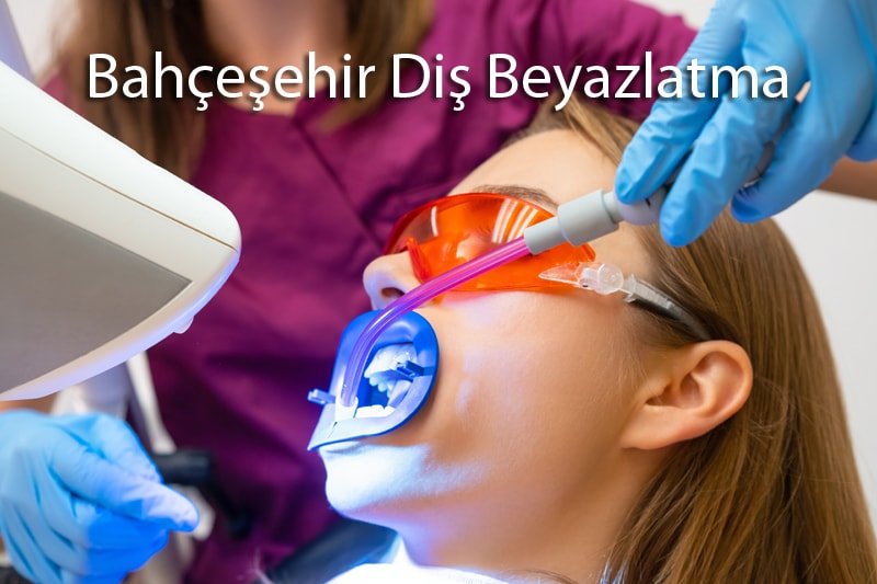 Bahçeşehir Diş Beyazlatma: Işıltılı ve Bembeyaz Bir Gülüş Sizi Bekliyor